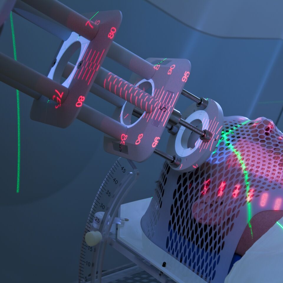 COLOUR-IMAGE_healthcare-radiotherapy-cancer-treatment_feb26