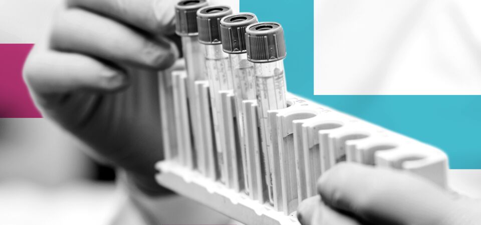 BLOG-HEADER_test-tube-laboratory-equipment_jul24