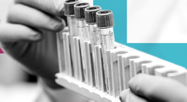 BLOG-HEADER_test-tube-laboratory-equipment_jul24