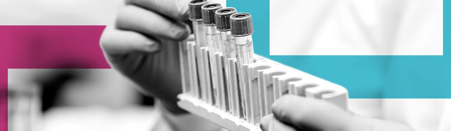 BLOG-HEADER_test-tube-laboratory-equipment_jul24